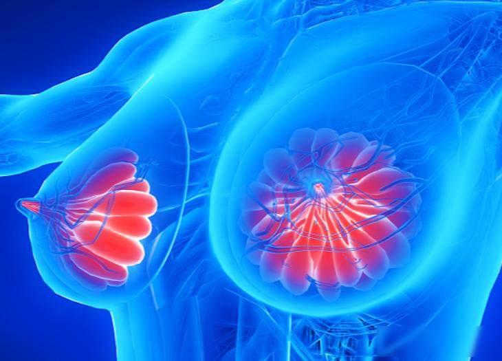 哈工大解剖398名乳腺癌死者，惊讶发现患乳腺癌的人，有几大特点


前阵子看到新