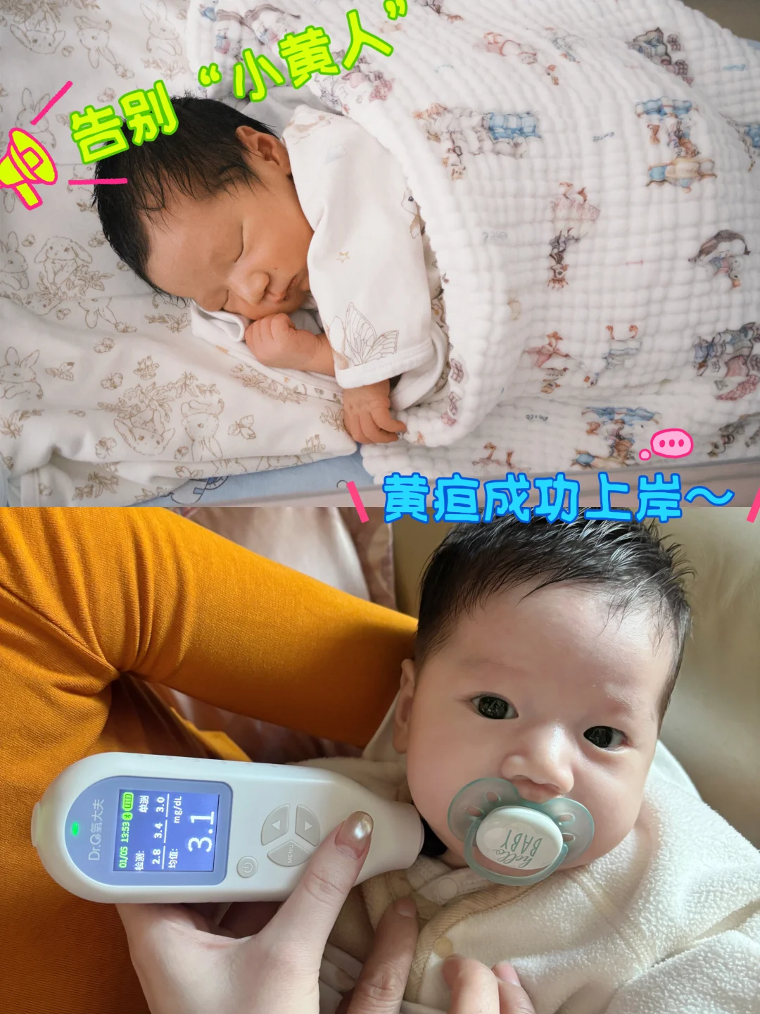 🤰产后30天｜分享一些关于黄疸的碎碎念