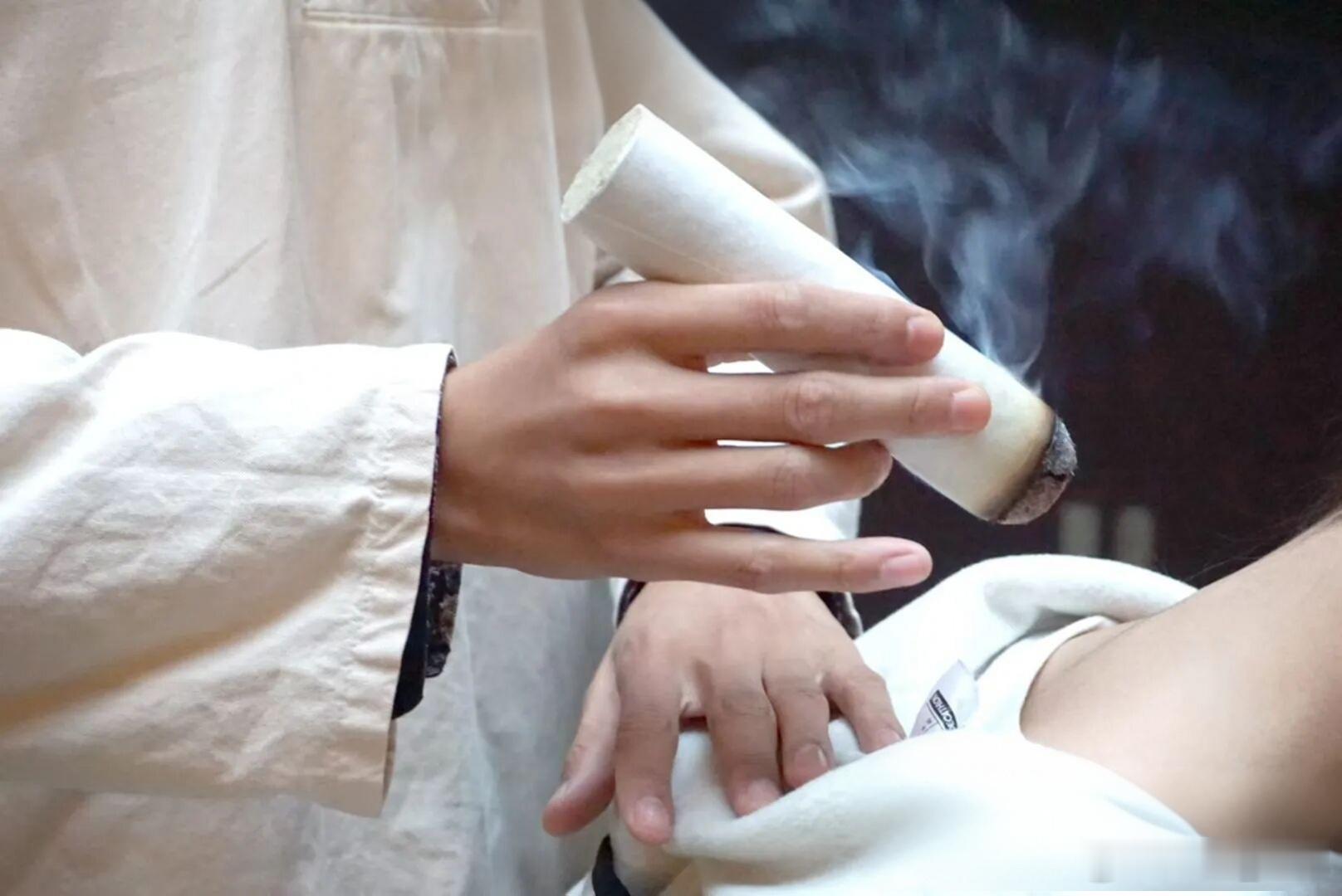 《扁鹊心书》艾灸操作流程（贴合一气周流+儿科适配版）核心遵循《扁鹊心书》“灼艾保