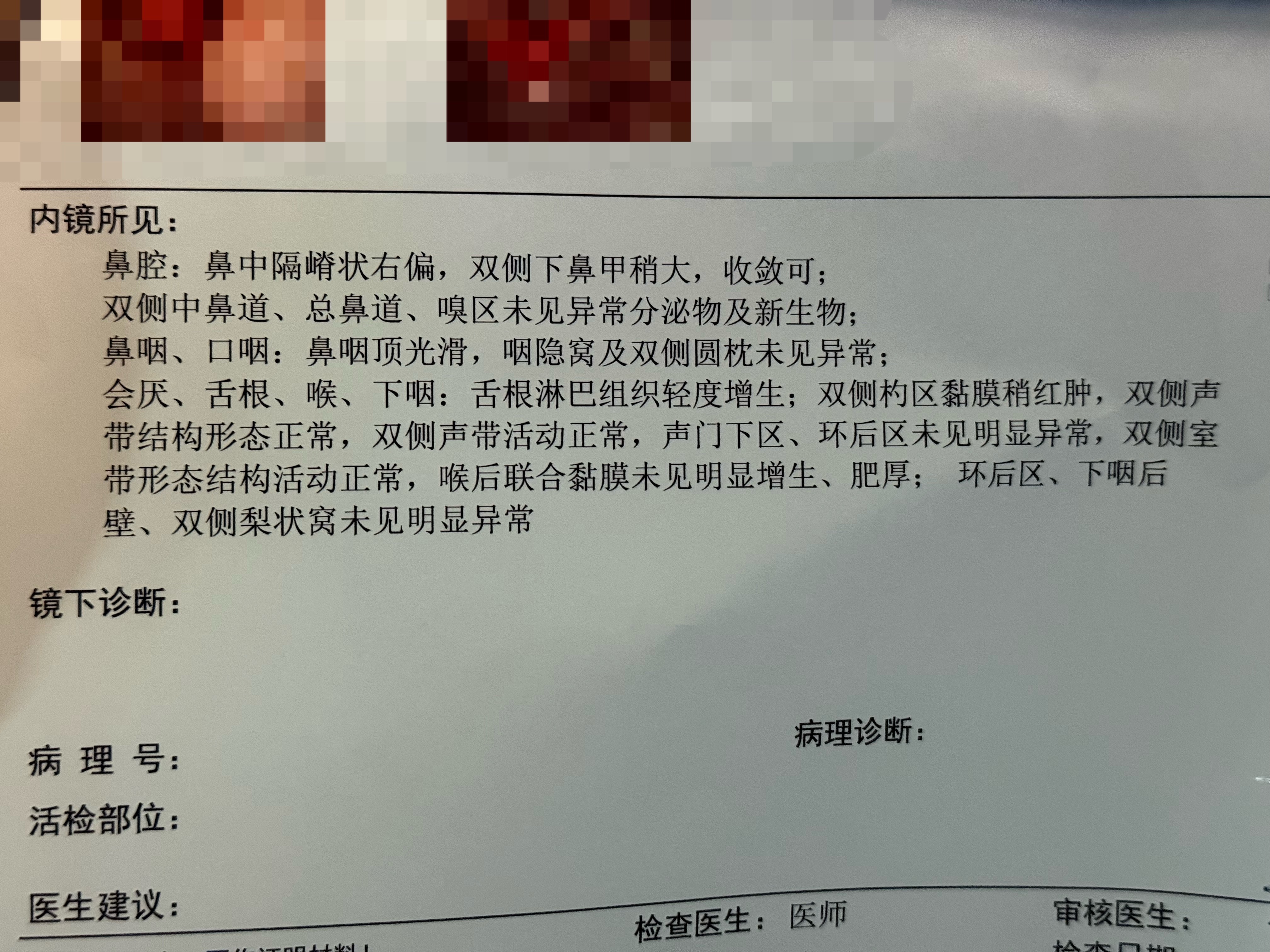 今天去做喉镜了，真的有点难受[融化]那根软线还是有点硬的，鼻子的部分还好，到喉咙