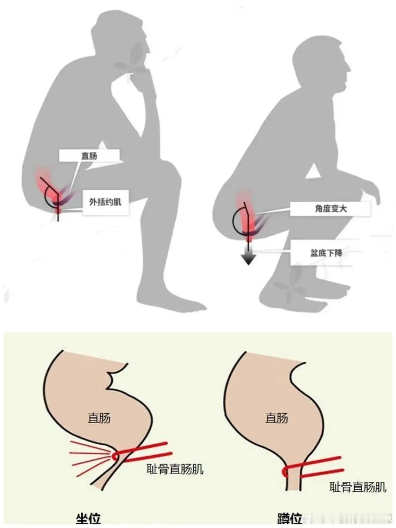 注意！马桶不如蹲坑痛快！你发现没有，平时去“大号”，坐马桶总感觉有一丢丢“不尽人
