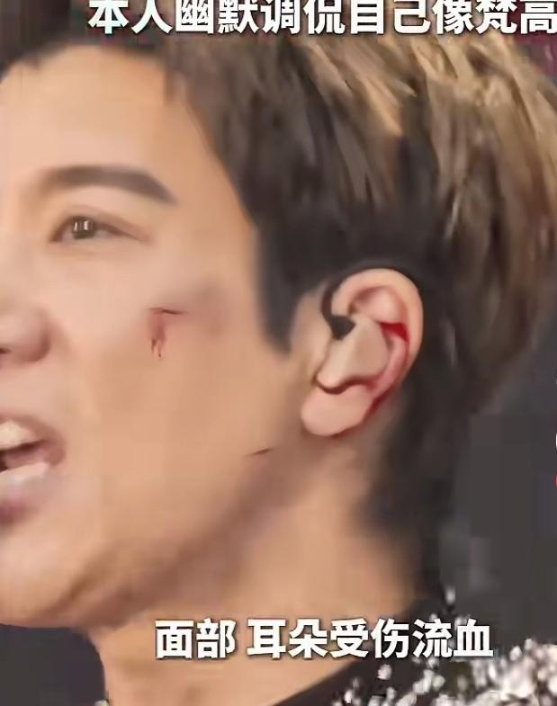 舞台上的血与光：
致敬王力宏的敬业

7月4日晚，王力宏在成都“最好的地方II”
