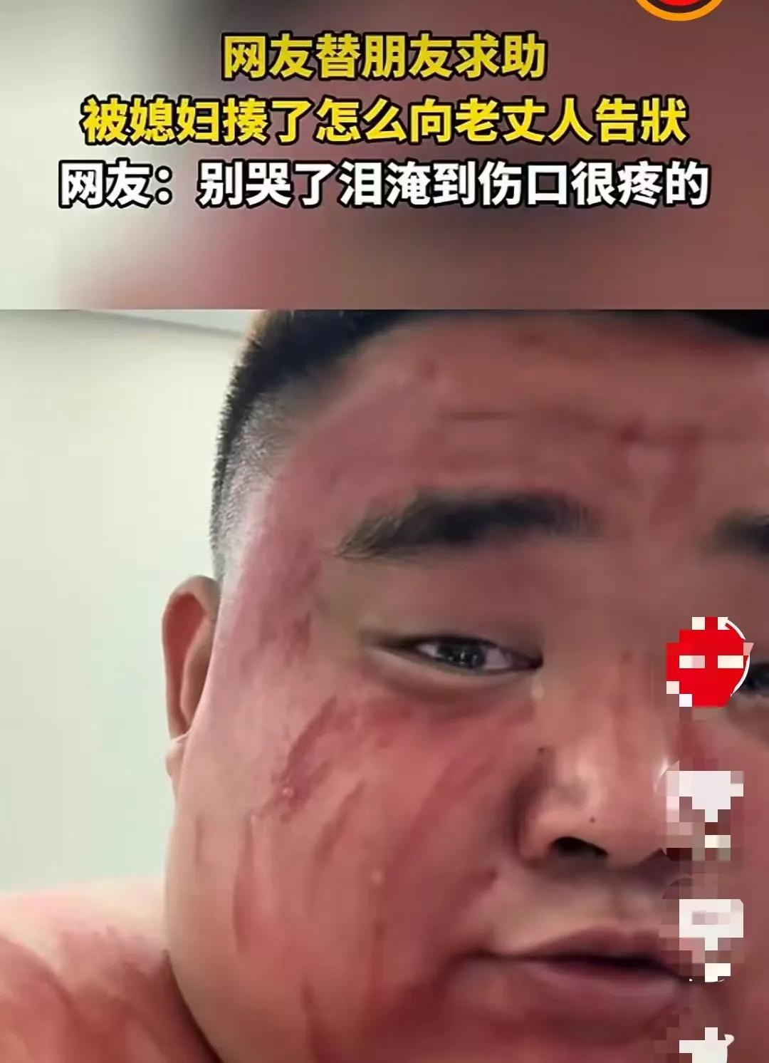 湖北。
男子被媳妇打了，去哥们家避难。信誓旦旦说要去老丈人家，让他评评理。百般找