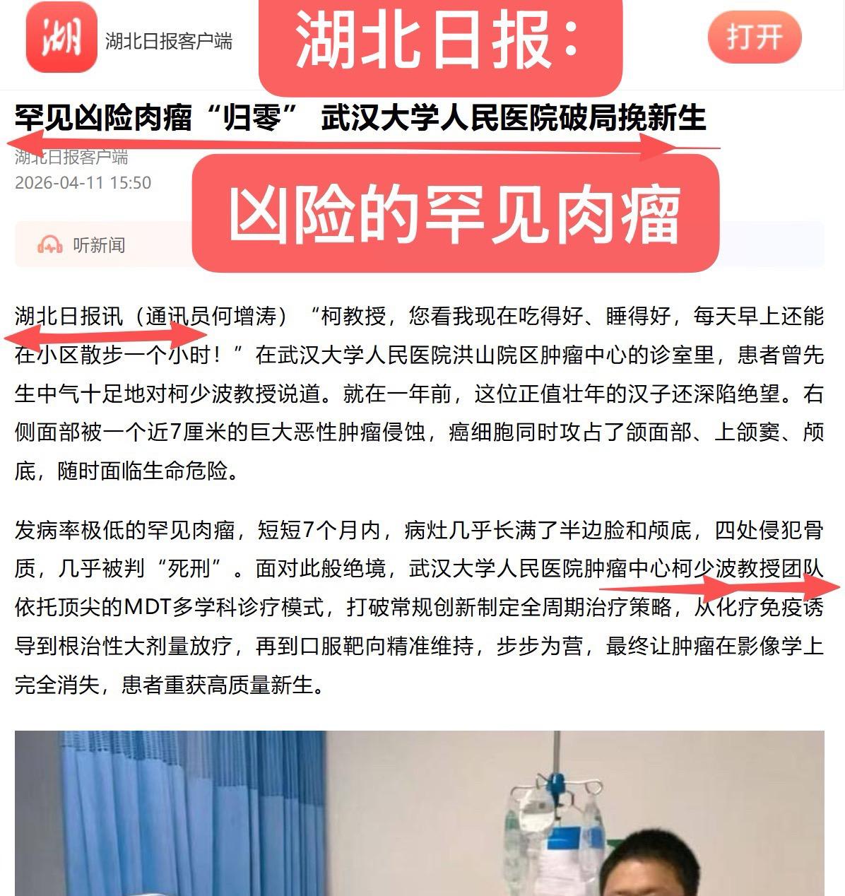 湖北日报：凶险的罕见肉瘤。湖北日报宣传！