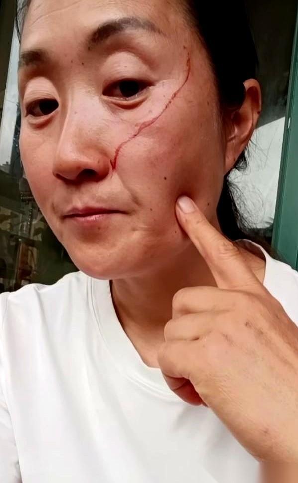 高考刚结束，一个女孩硬生生把亲妈的脸挠出了血。
起因荒唐得让人发指：妈妈起早贪黑