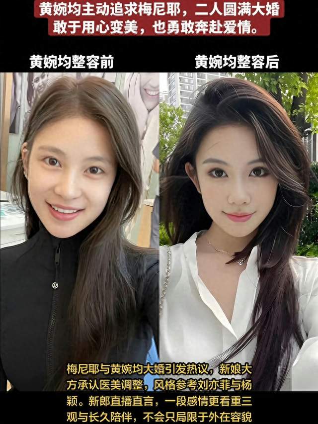 梅尼耶被妻子整容前的照片吓到了？细看才懂：好看就是自带的底气