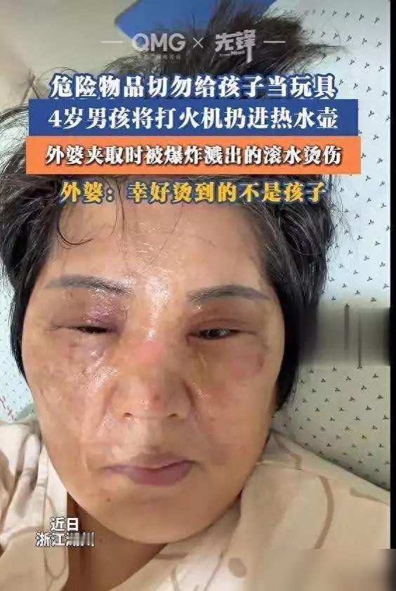 浙江湖州，4岁外孙趁大人不注意把打火机扔进刚烧开的热水壶，外婆急忙用筷子去夹，没