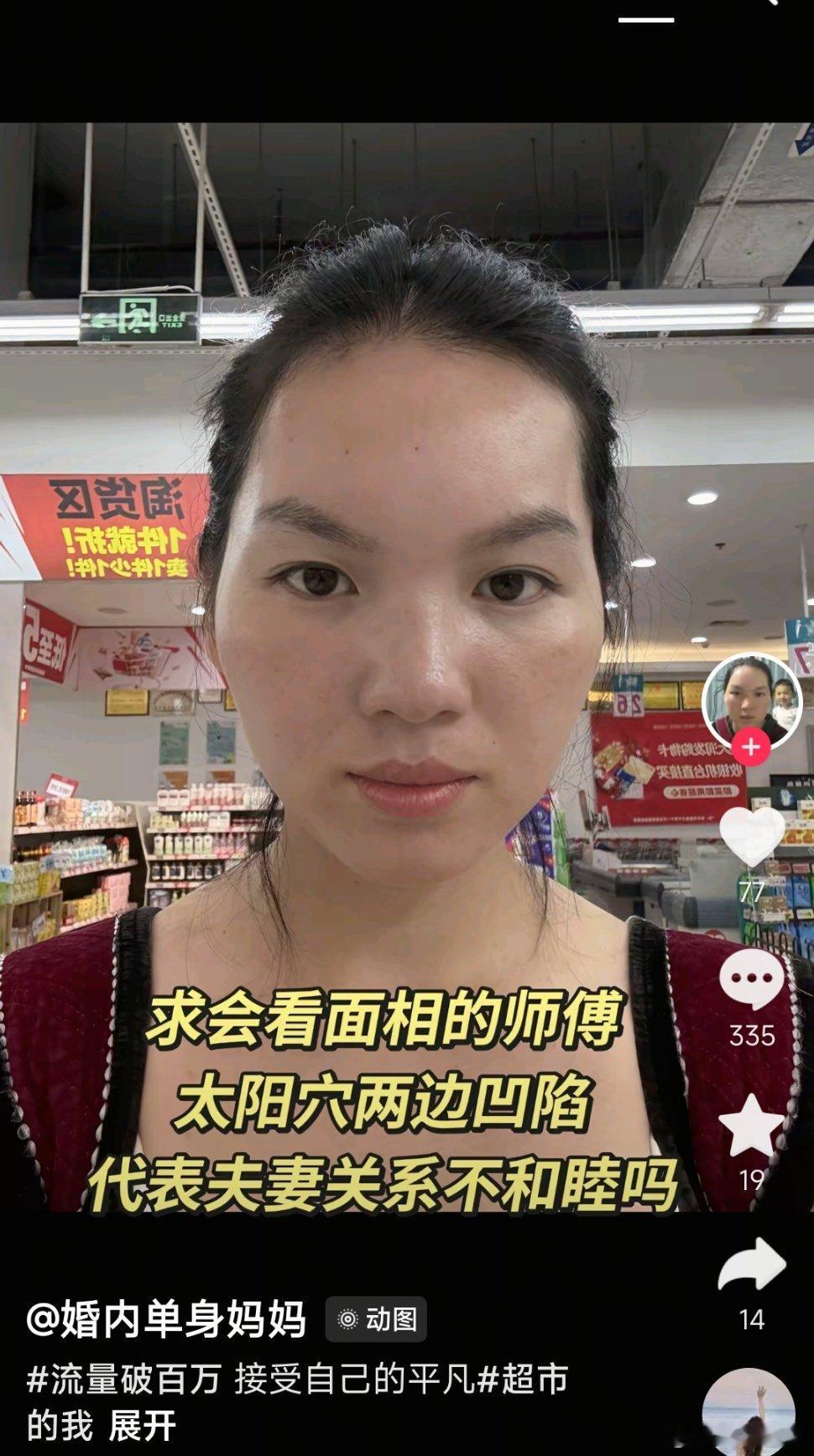 其实名字已经说明了啊，可能是需要一个说法而已，单单太阳穴凹陷这一处倒不算太重，但