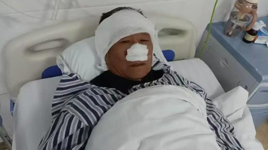 勇斗歹徒被咬掉鼻子，见义勇为不问年龄
近日，湖南郴州嘉禾发生一起突发伤人事件：一