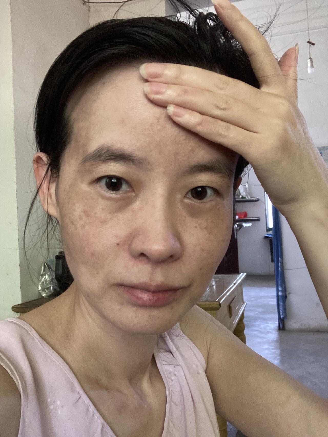 额头遮起来是这样的，每天困的不得了。因为没有房子，休息不好，住在农村，事情又多，