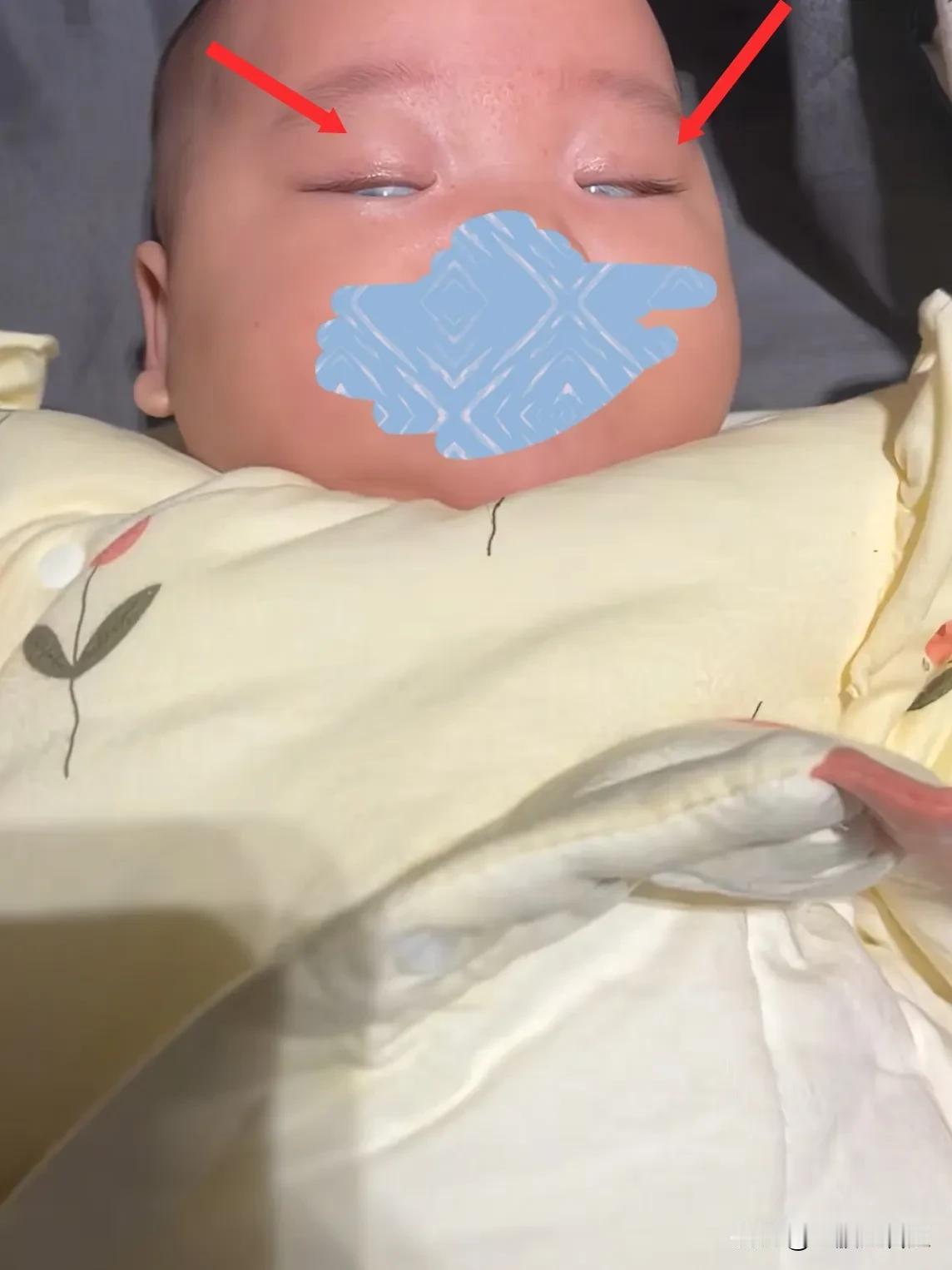 这孩子是不是落日眼啊？
      
偶然间刷到一位重庆宝妈的视频，她家孩子才3