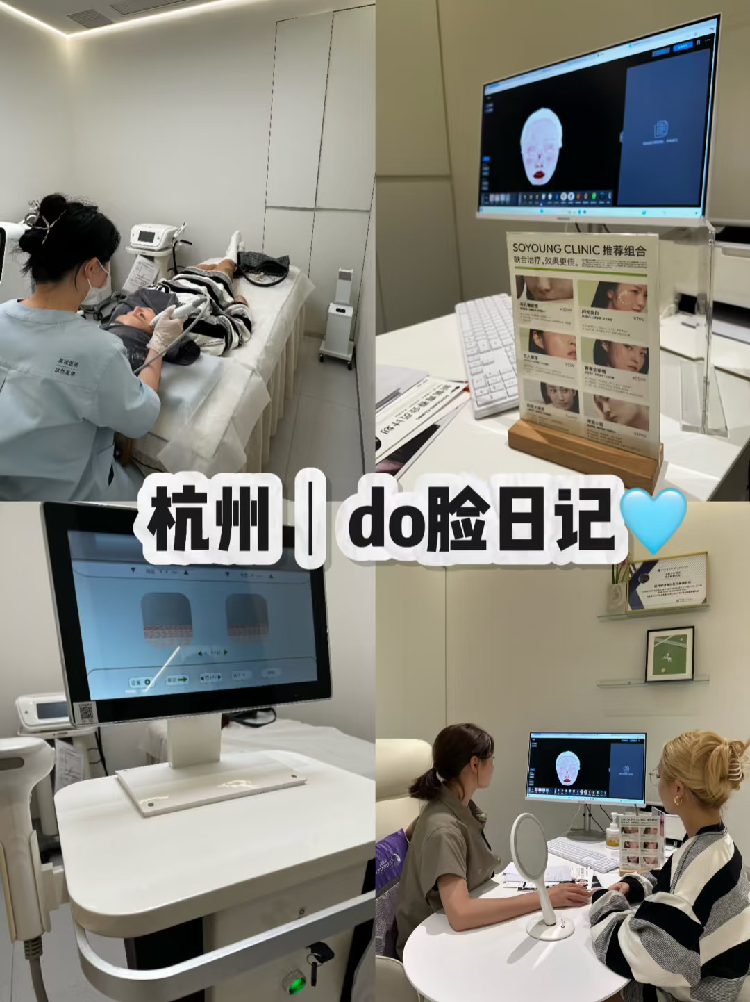 do脸日记｜在杭州体验超声线雕的一天🩵