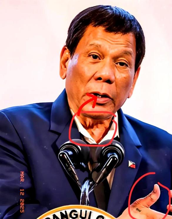 2026年1月26日，国际刑事法院正式裁定，80岁的菲律宾前总统杜特尔特身体状况