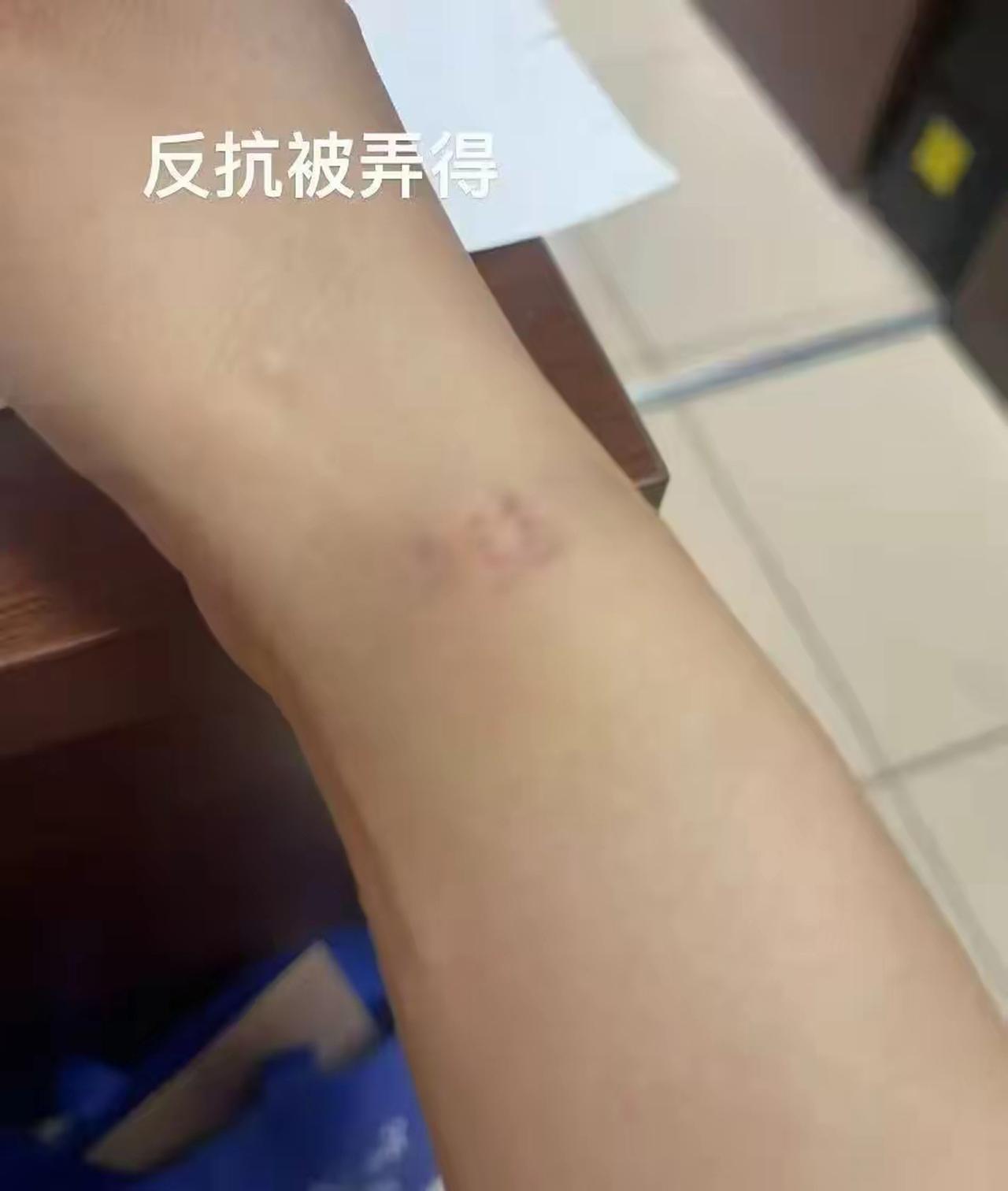 【住院女患者称遭男医生侵犯警方未立案，周兆成：警方坚守证据底线，点赞！】
 
大