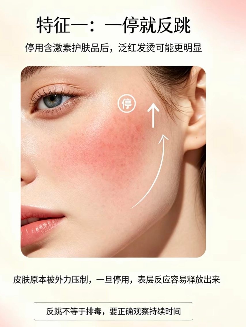 激素脸｜你的脸，被激素惯坏了⚠️简单说：皮肤对激素上瘾，不用就烂脸，一用就变好。