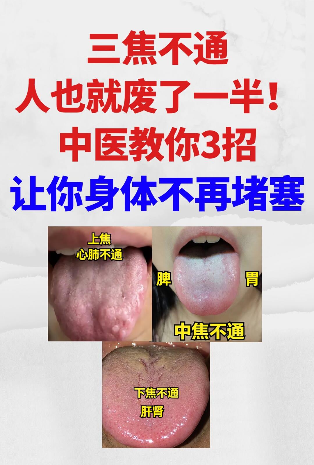 三焦不通，人也就废了一半！[灵光一闪]
中医教你3招，上通心肺，中通脾胃，下通肝