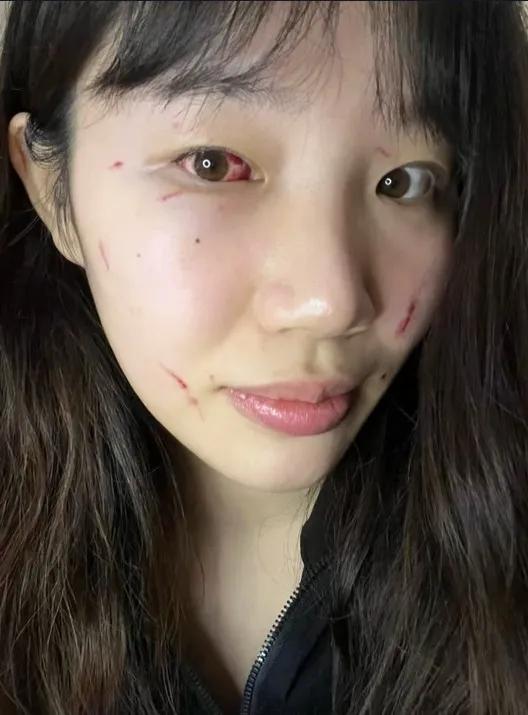 北京女篮刘晶被打伤，篮球场不是法外之地，在这里就可以肆无忌惮吗？

昨晚的WCB