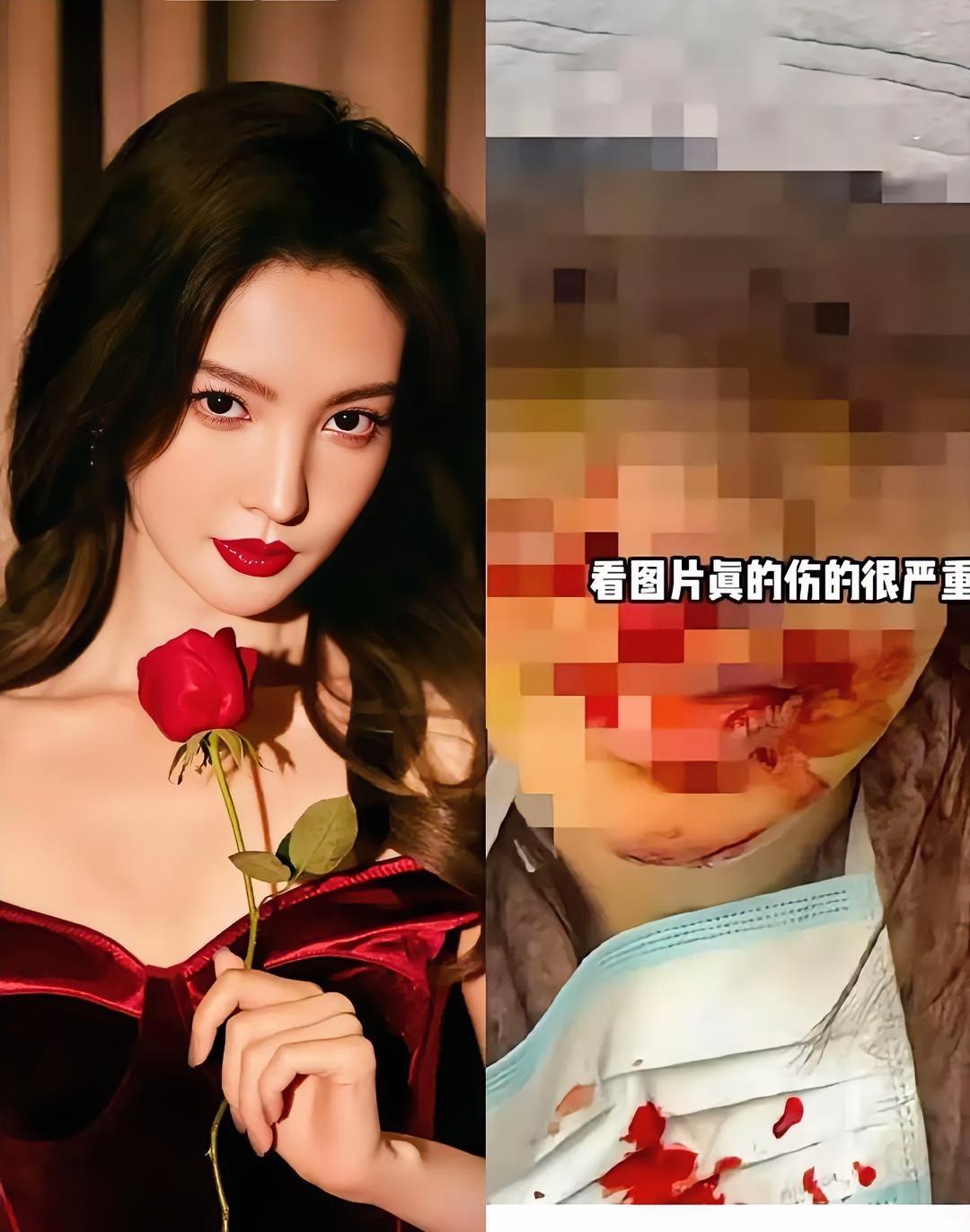 金晨身边人爆出这事挺吓人。都过去一年了突然拿出来，分明是想把她拖到泥里。肯定不是