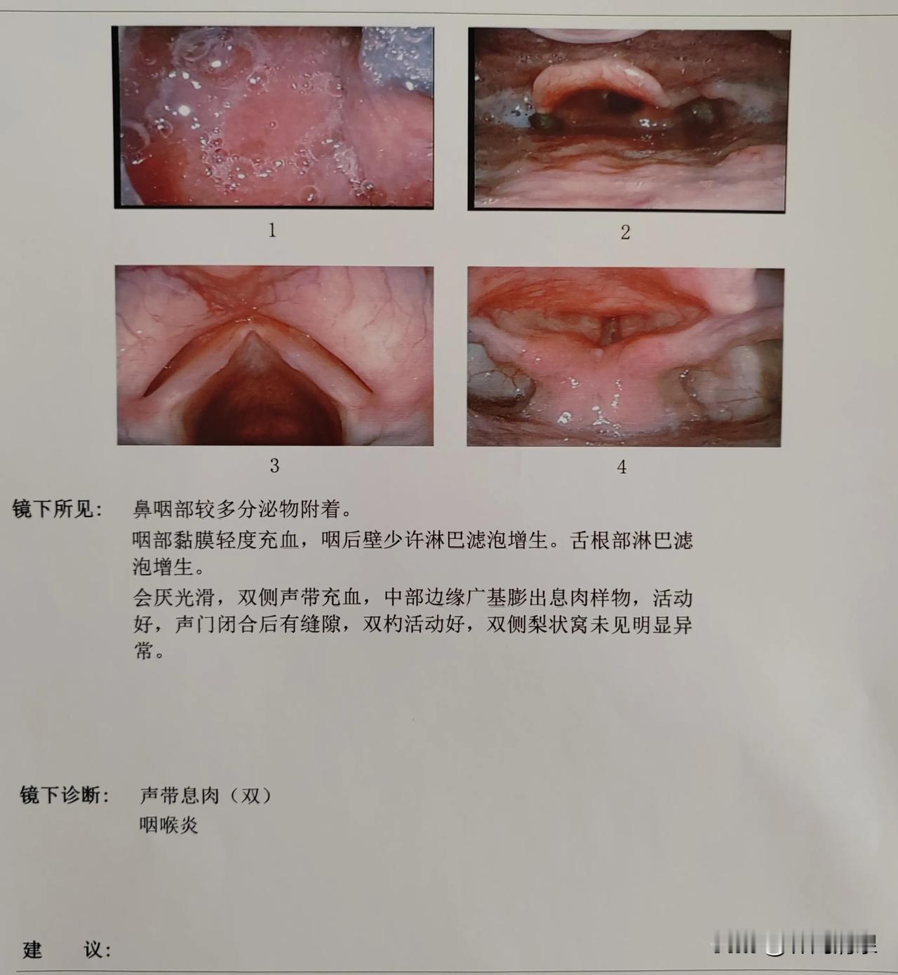 现在医院特黑。
       感冒后嗓子哑了十多天了，吃了各种药不见好。于是今天