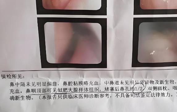 腺样体肥大，只有这一种情况需要做手术！
大家好，我是孟牛安。在门诊上，每天都会遇