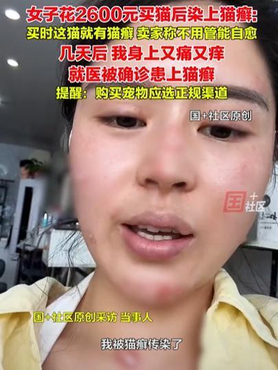 “担心的事还是发生了！”浙江一女子花2600元买了只猫，可没过几天，女子身上就开