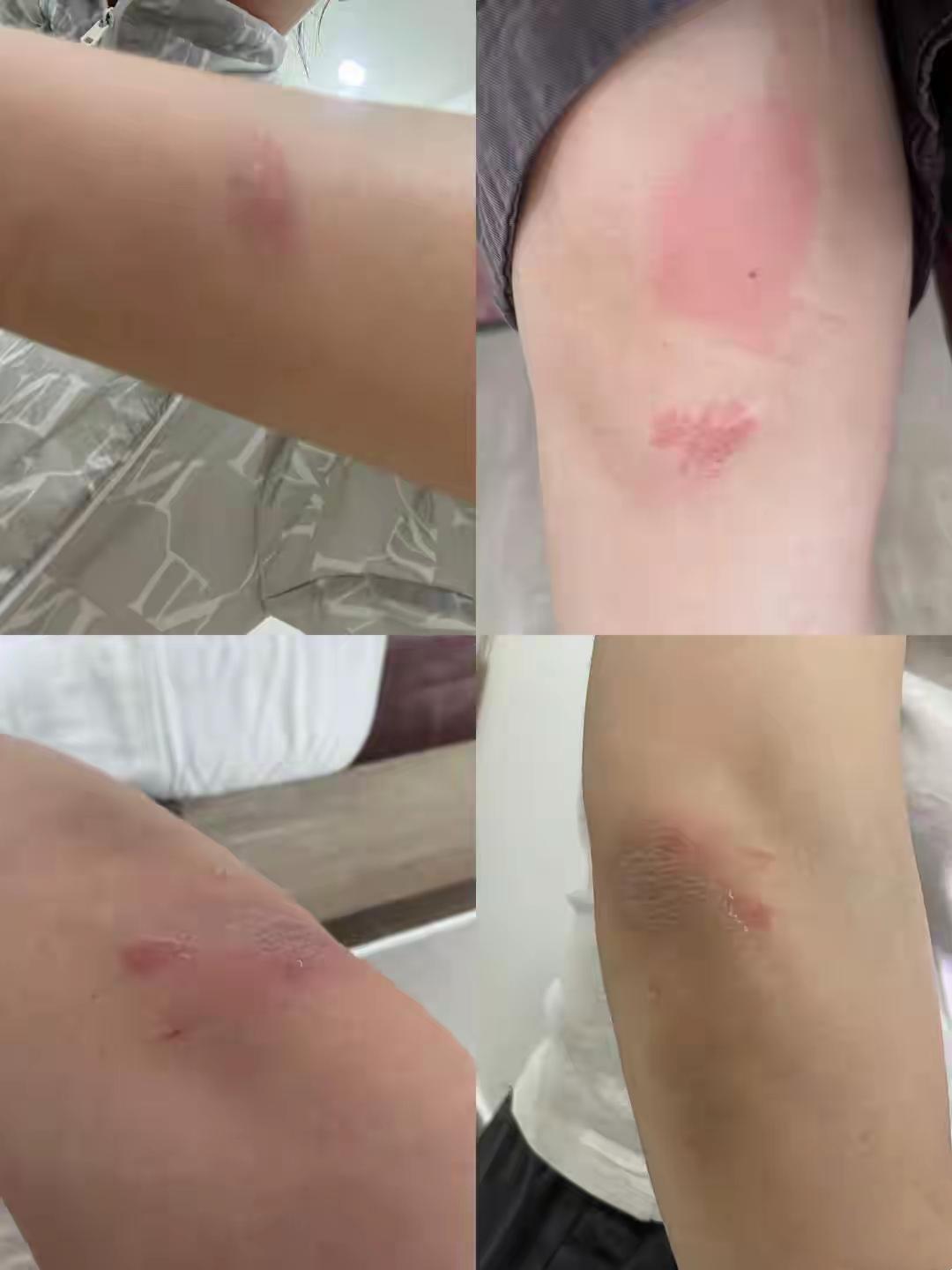 你敢信吗？好好上着班，人却被从三楼一路拖到一楼，手机被抢，眼镜被打飞，身上全是瘀