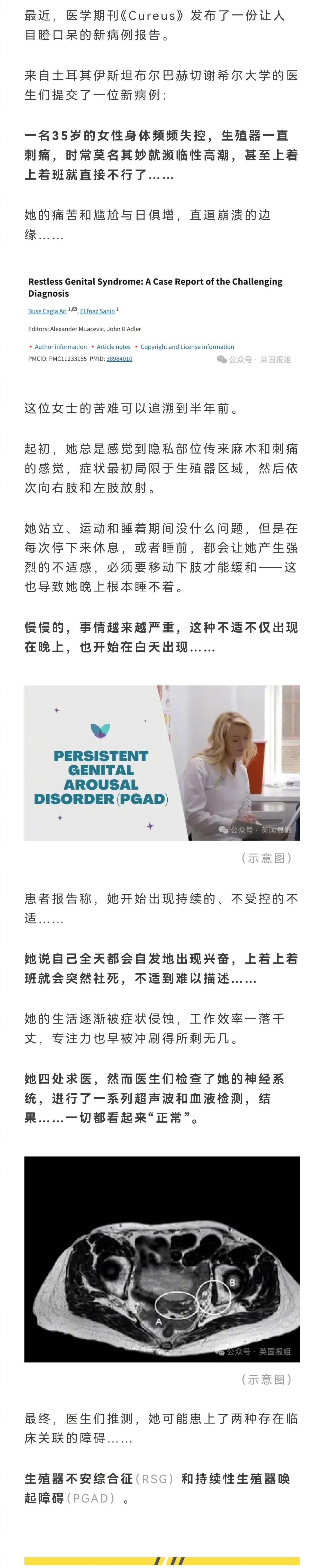 土耳其一名女子罹患罕见病，下体一直刺痛，每天都会莫名其妙濒临高潮，严重影响到日常