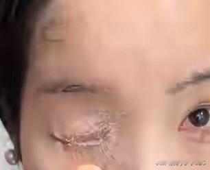 1月5日，贵州贵阳发生的一幕令人唏嘘：一位女子为了美丽，用502胶水粘贴指甲片，