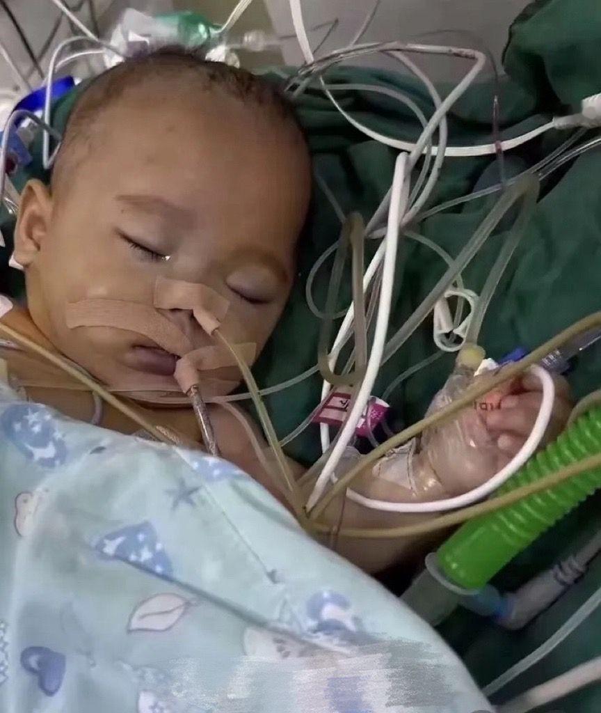 涉事医院否认小洛熙房缺为3mm以精诚之心护生命之重小洛熙事件的争议，叩问着医疗行