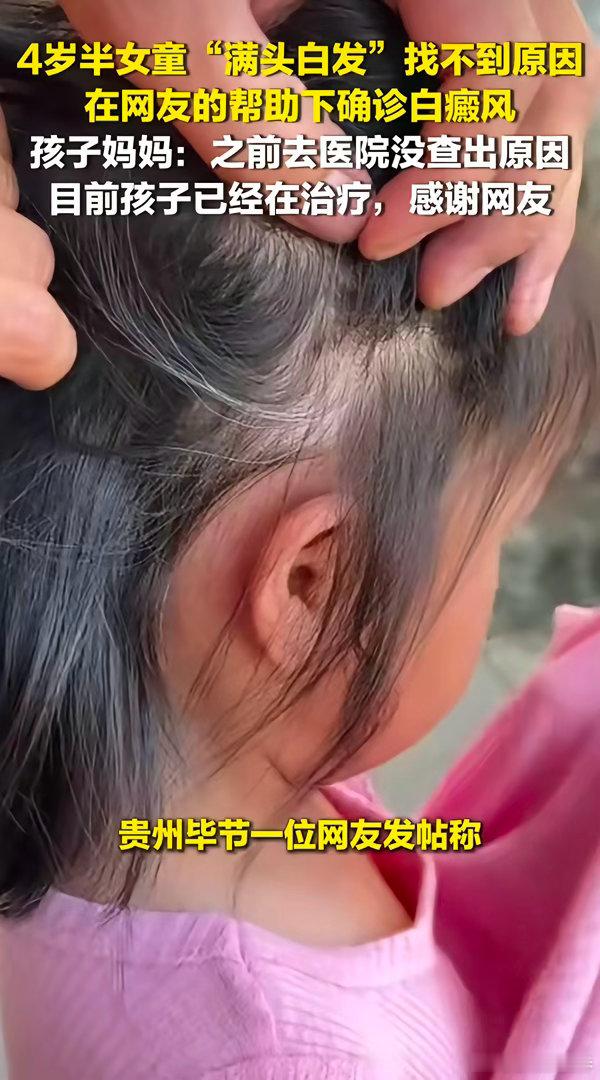 网友的含金量还在继续上升。近日，贵州一位宝妈发帖求助，自己4岁女儿出现了大量白发
