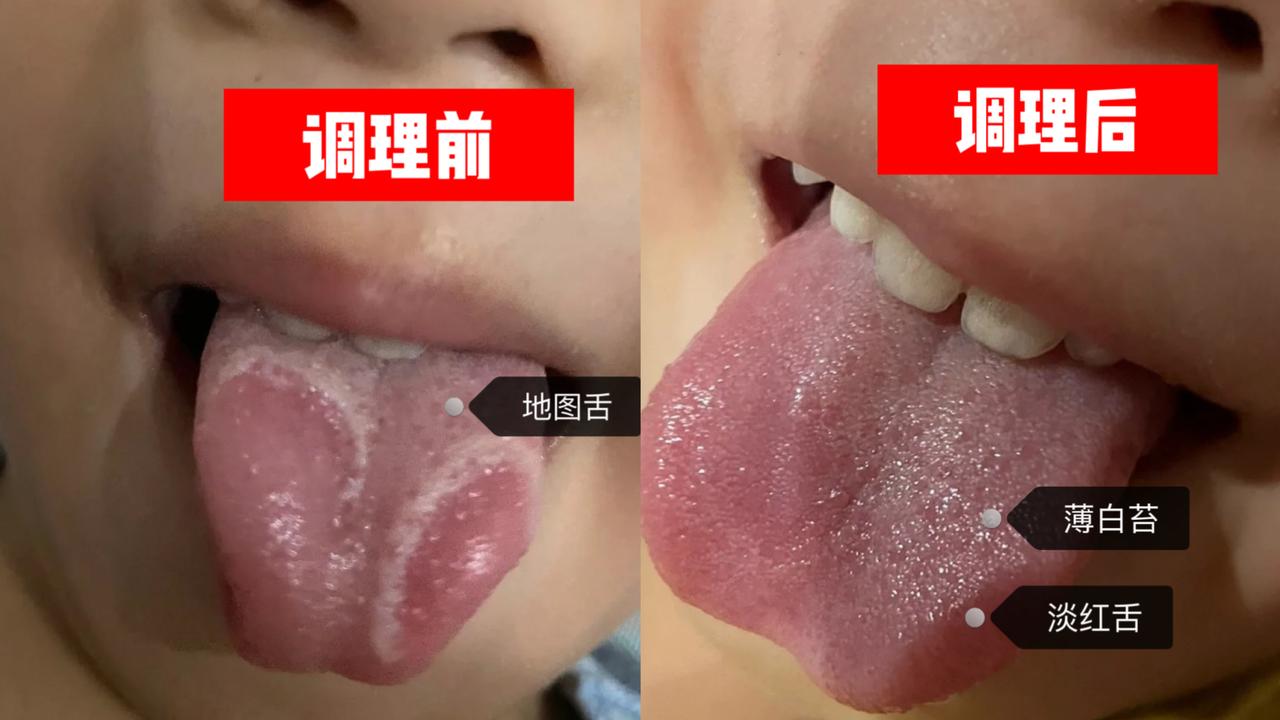 孩子舌苔正常了，消化好了，长速也稳步提升！
 
这是前几天一位家长的反馈，线上复