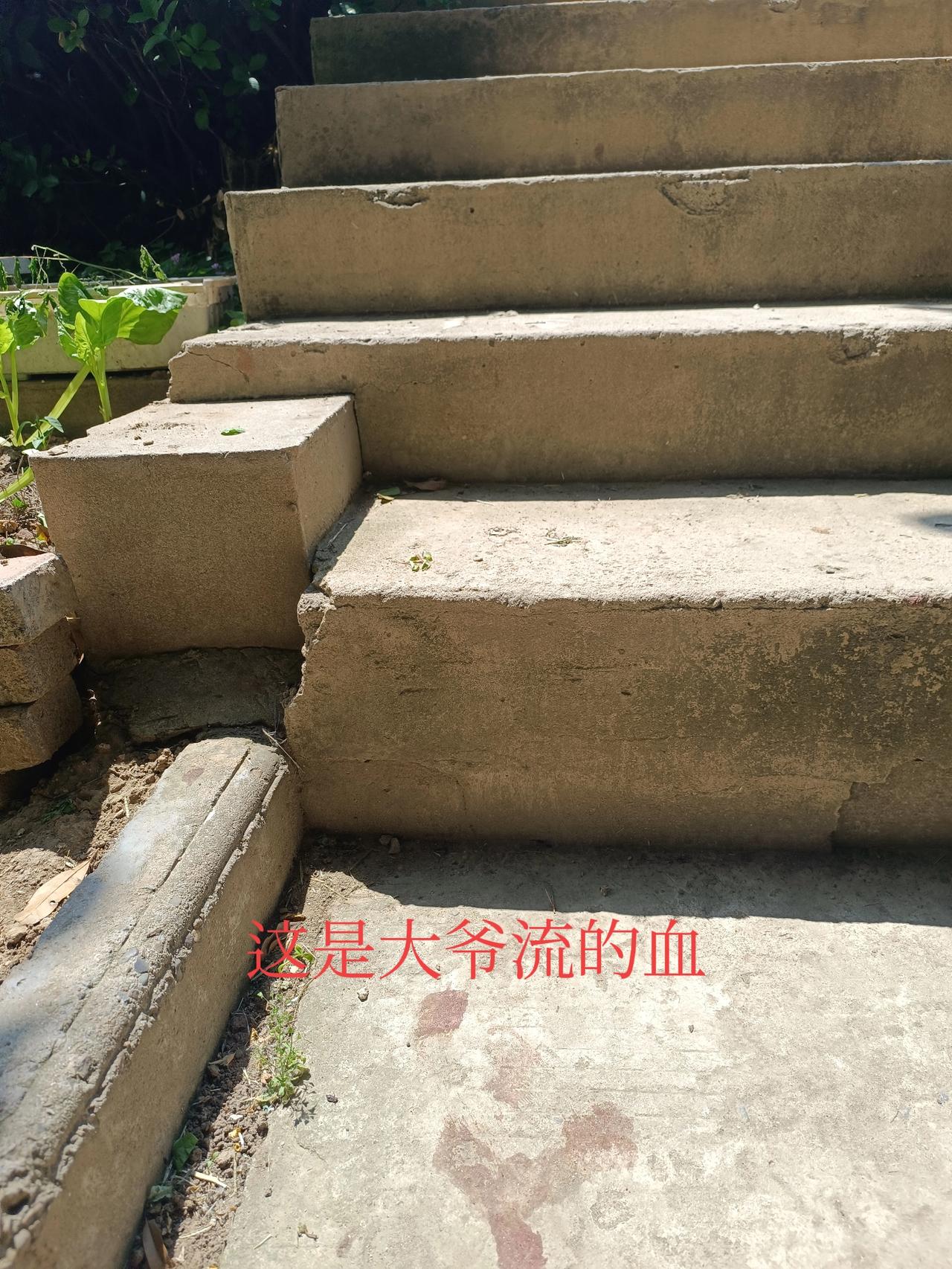 就在刚才，邻居大爷从台阶上摔倒了，头磕在台阶上，地上流了一片血。

大爷今年87