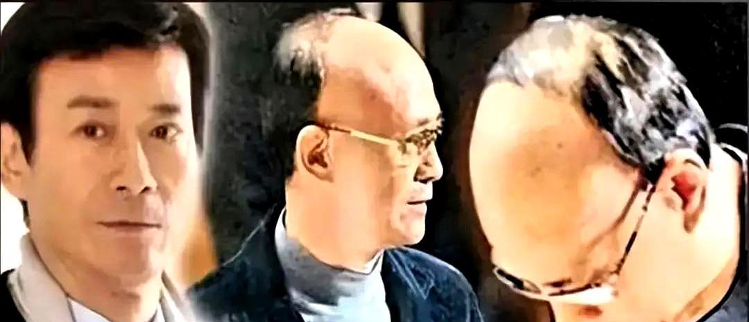 头皮上的胶水还没干透。1979年，郑少秋在片场，把工业级强力胶直接怼上头皮。
为