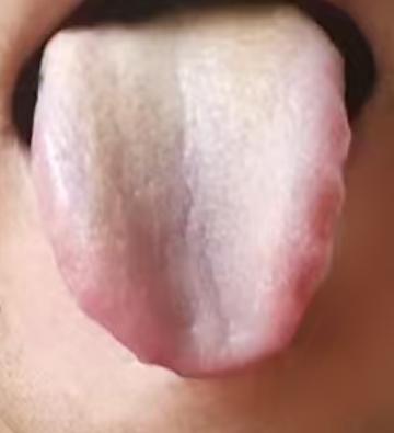 下焦失固易敏感，温阳化湿逐瘀调理







很多朋友之所以会出现海绵体低下的