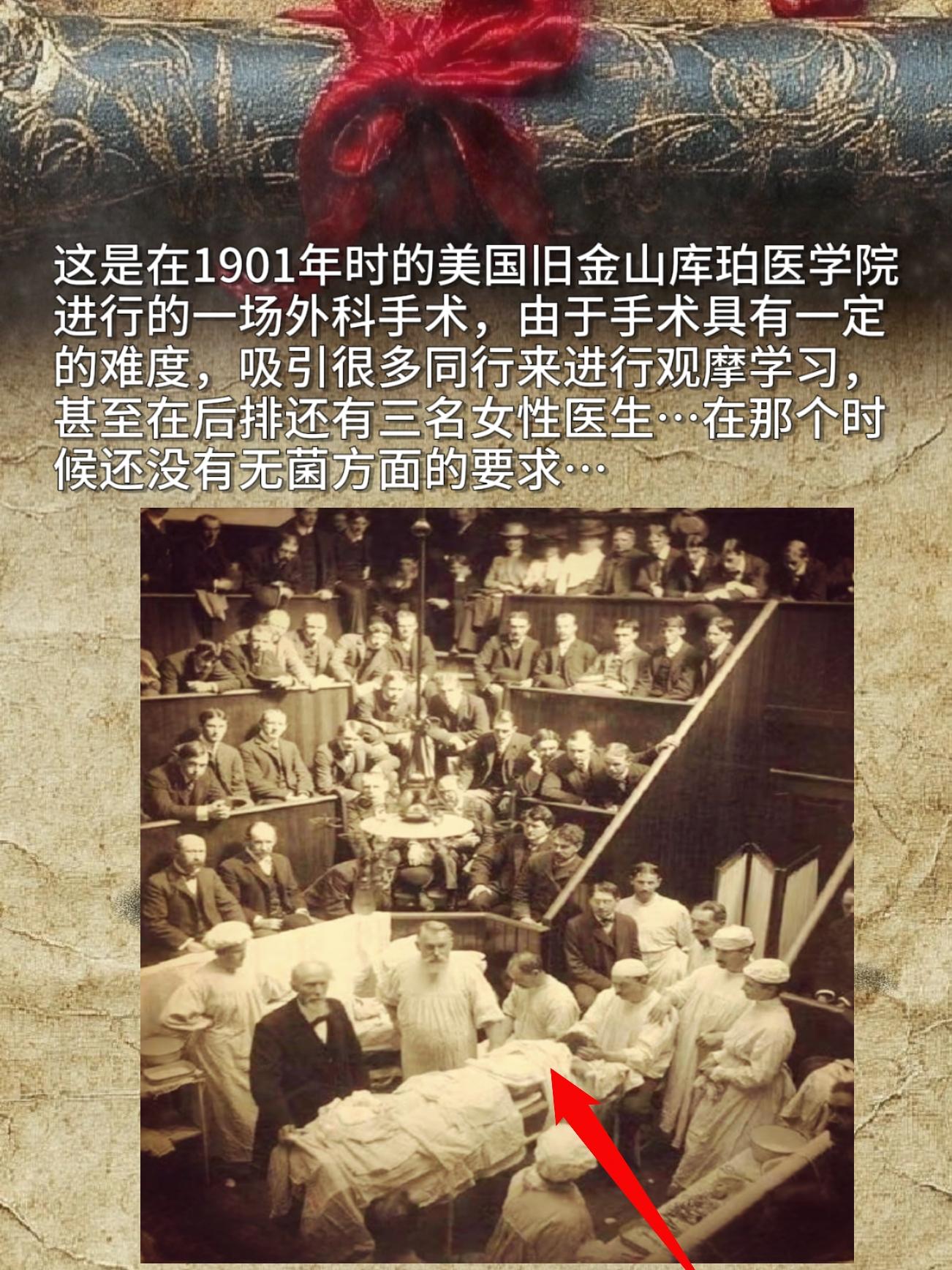这是在1901年时的美国旧金山库珀医学院进行的一场外科手术，由于手术具...