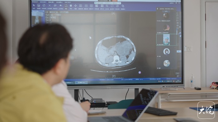 【】“从影像上看，孩子现在已经符合紧急探查指征。”屏幕那端，身处北京协和医院的王