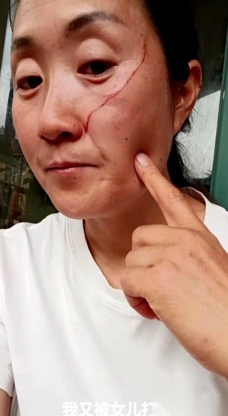 玻璃杯砸在瓷砖上碎得哗啦响，一道长长的血口子从这位陪读妈妈的脸颊上划开，血珠子当