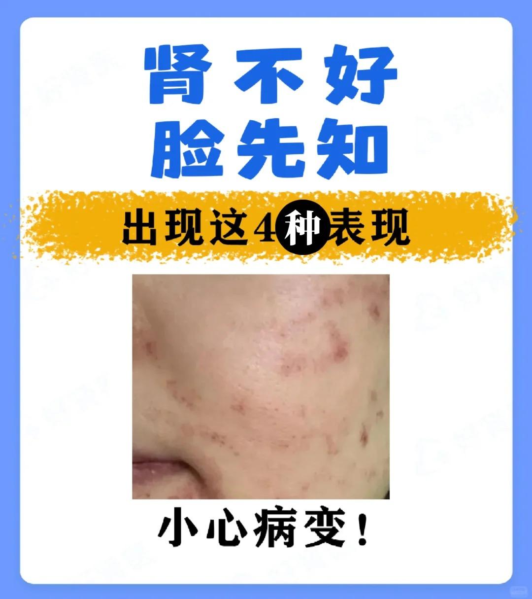 肾不好，脸先知，出现这四种情况要当心！