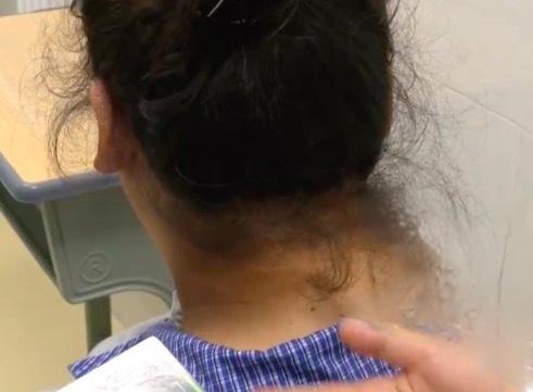 13岁，212斤，糖尿病晚期。别等孩子喘不上气了，才想起零食袋子有多沉。

一包