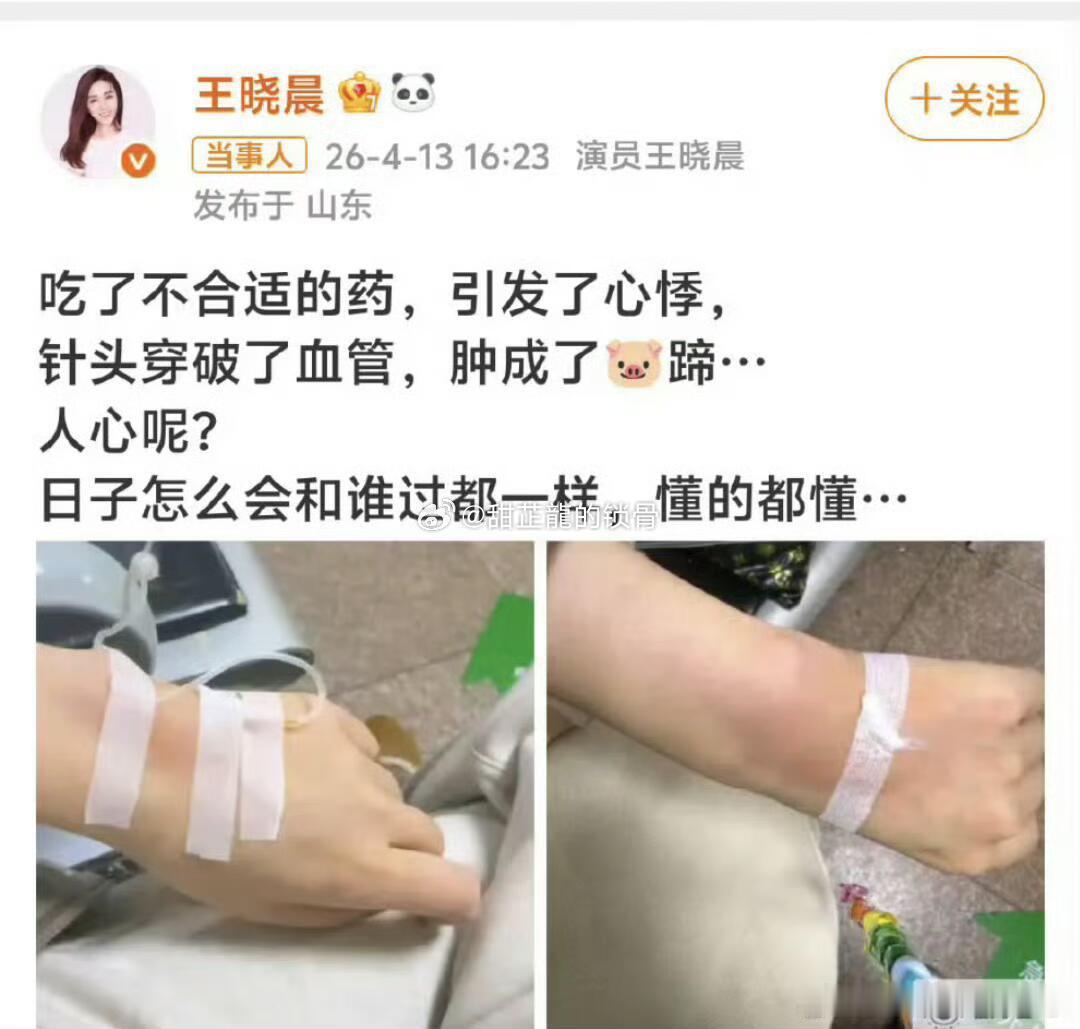 王晓晨俞灏明就医心理科两人因合作网剧《惩戒者》相识，在剧中饰演情侣，后续戏外关系