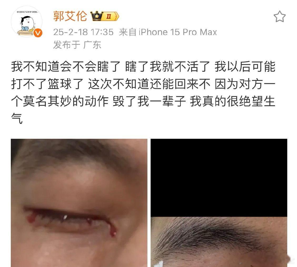 郭艾伦受伤 看到这个消息时，感觉自己眼睛都疼了一下。因为对方的一个举动，毁了他的