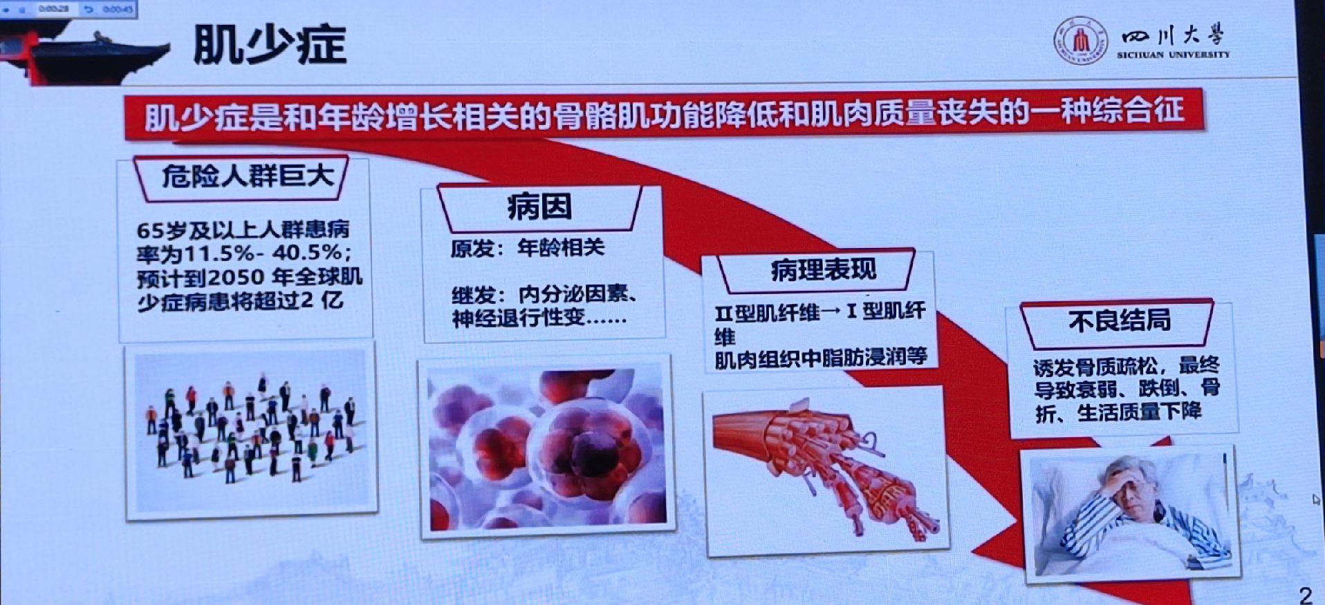 肌少症超声。