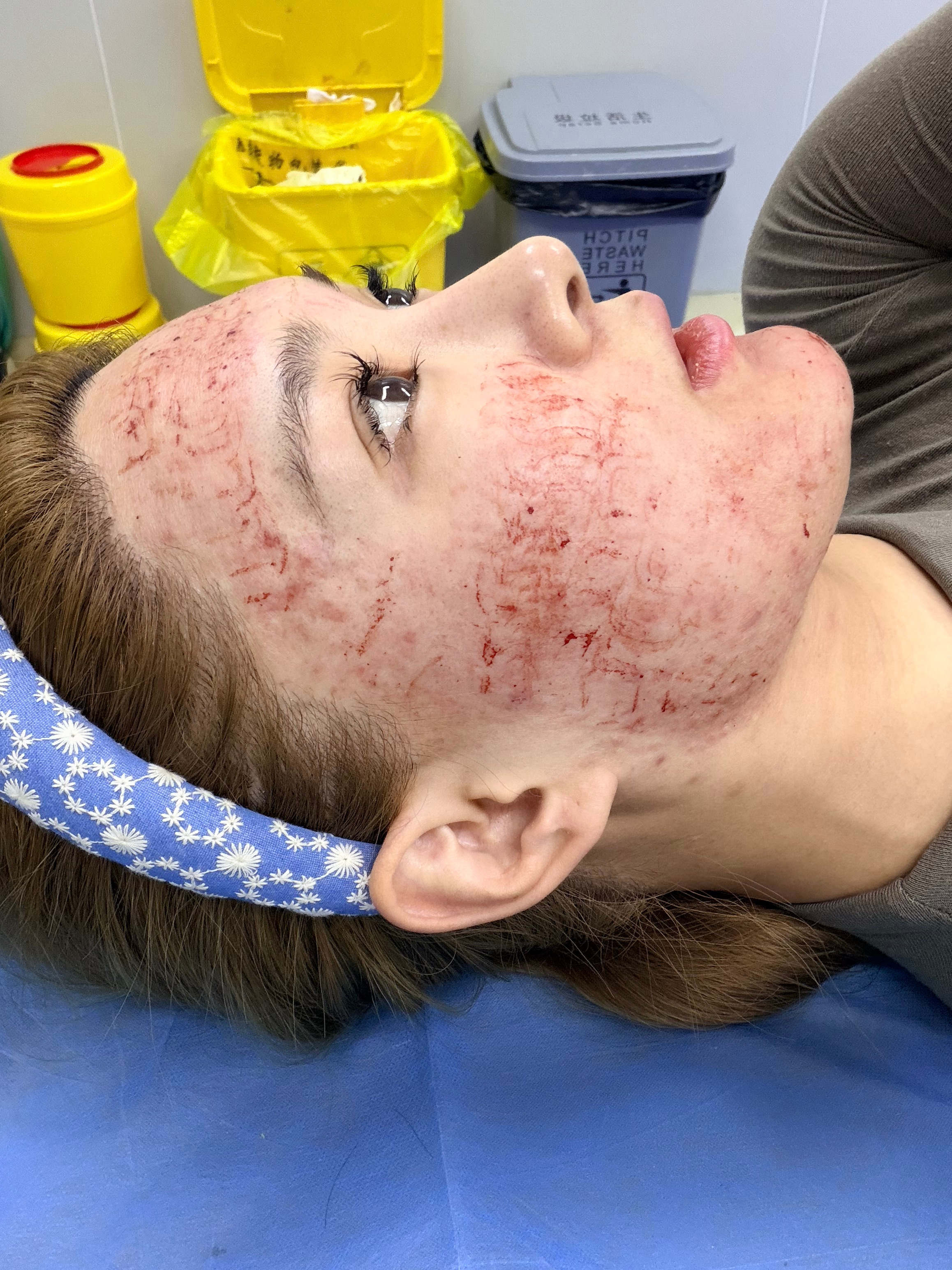 扛得住黄金微针的女人 这辈子当不了汉奸 