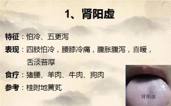 想知道自己的肾脏是否健康吗？其实，通过观察舌苔，就能初步判断自己的肾脏状况。今天