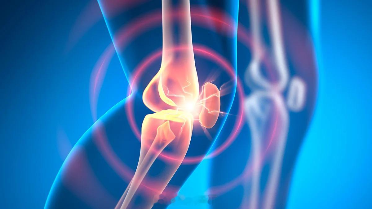 实验性药物在动物模型中数周内逆转骨关节炎 ScienceAlert 报道总结科罗