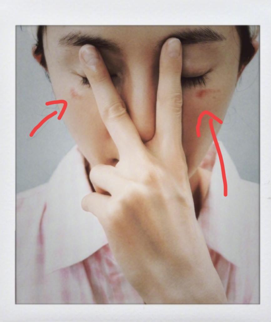 杨幂被蒸汽眼罩烫伤，

这护眼神器咋就成了毁容凶器

刚刷到杨幂的微博，眼下两道