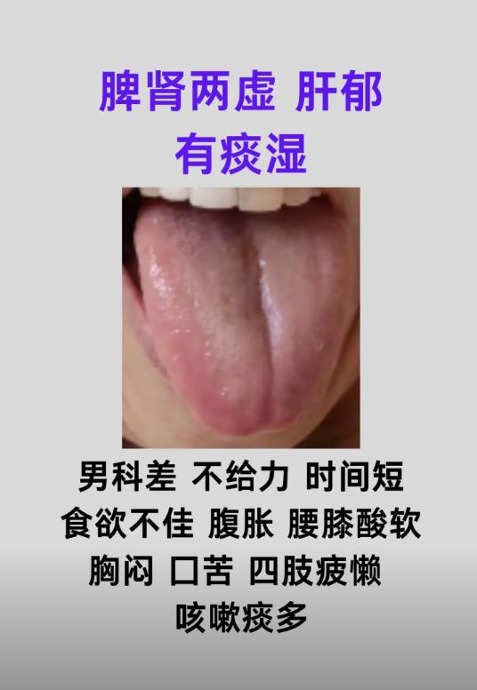3 种男性常见舌象，对应不同脏腑亏虚与痰湿问题