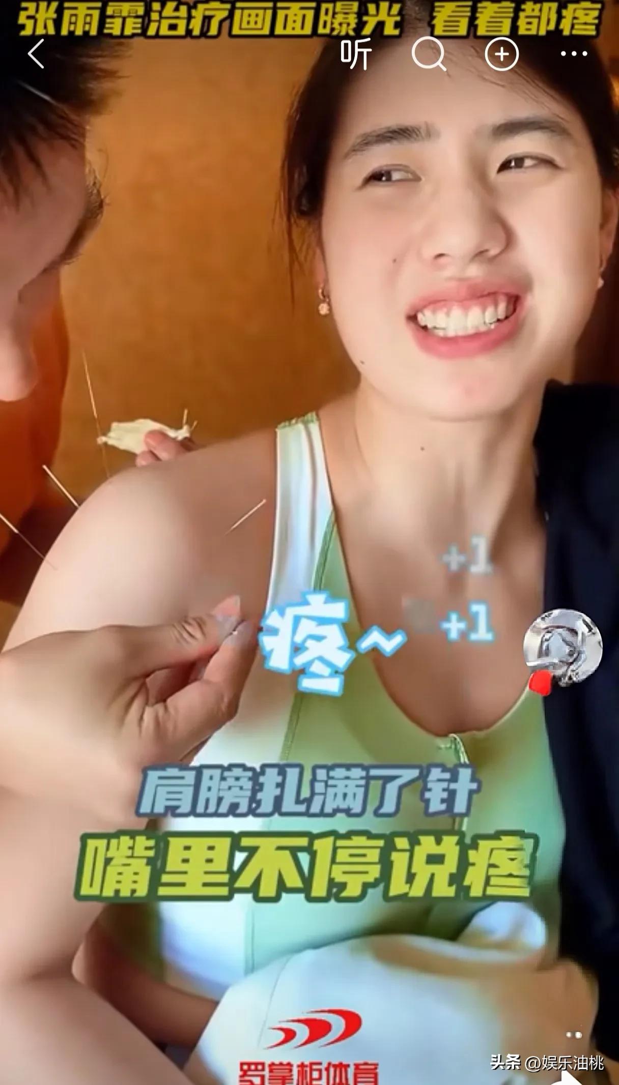 张雨霏坐在椅子上，肩膀密密麻麻扎满银针，嘴里一直喊“疼”，但没让医生停下来。
