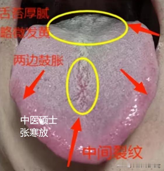 20出头，还没结婚，身体就造成这样，确实不多见啊[狗头][狗头][狗头]
主诉就