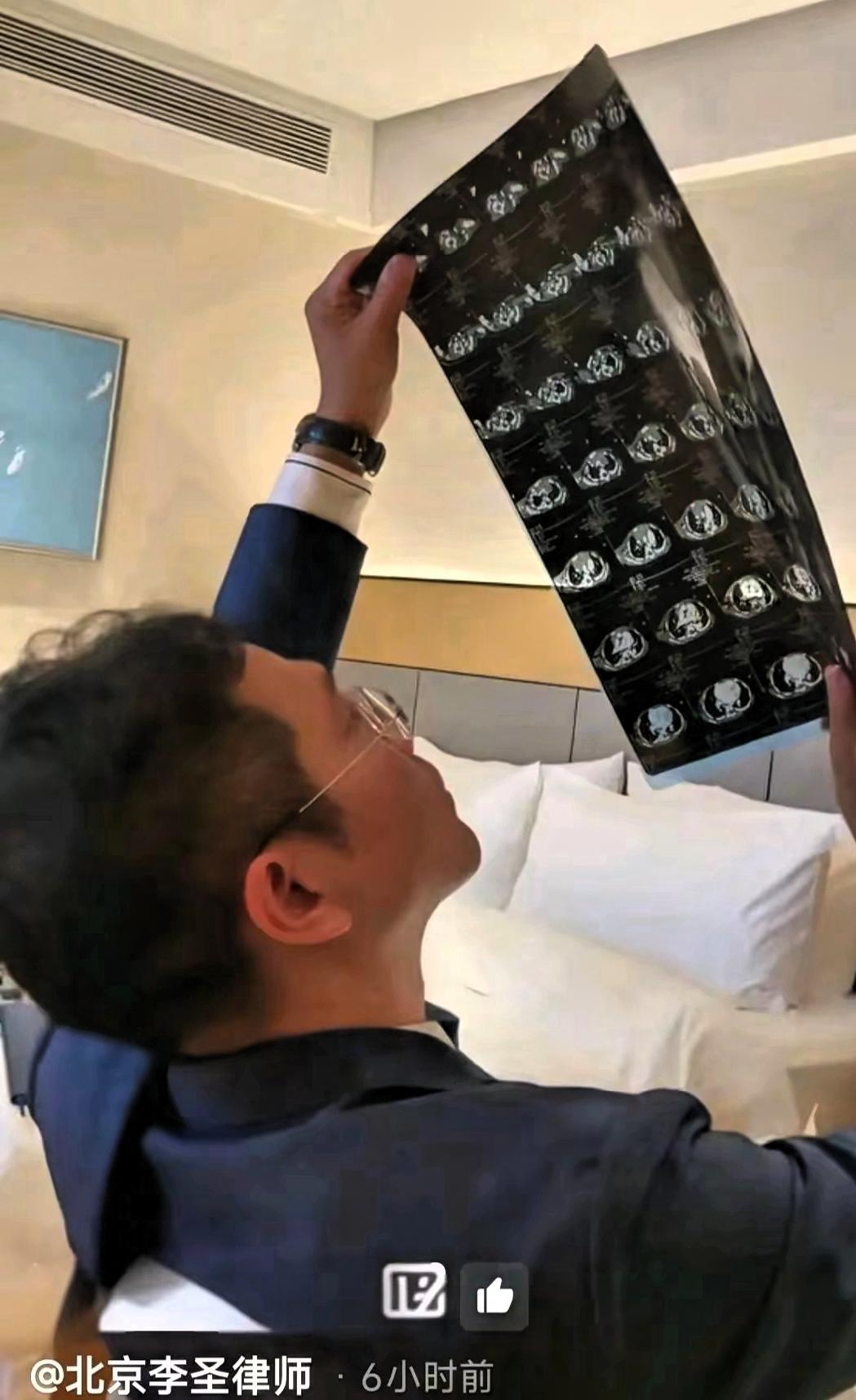 内行看门道，外行看热闹。
视频刷到李圣律师专注看医学影像片子的模样，才明白什么叫